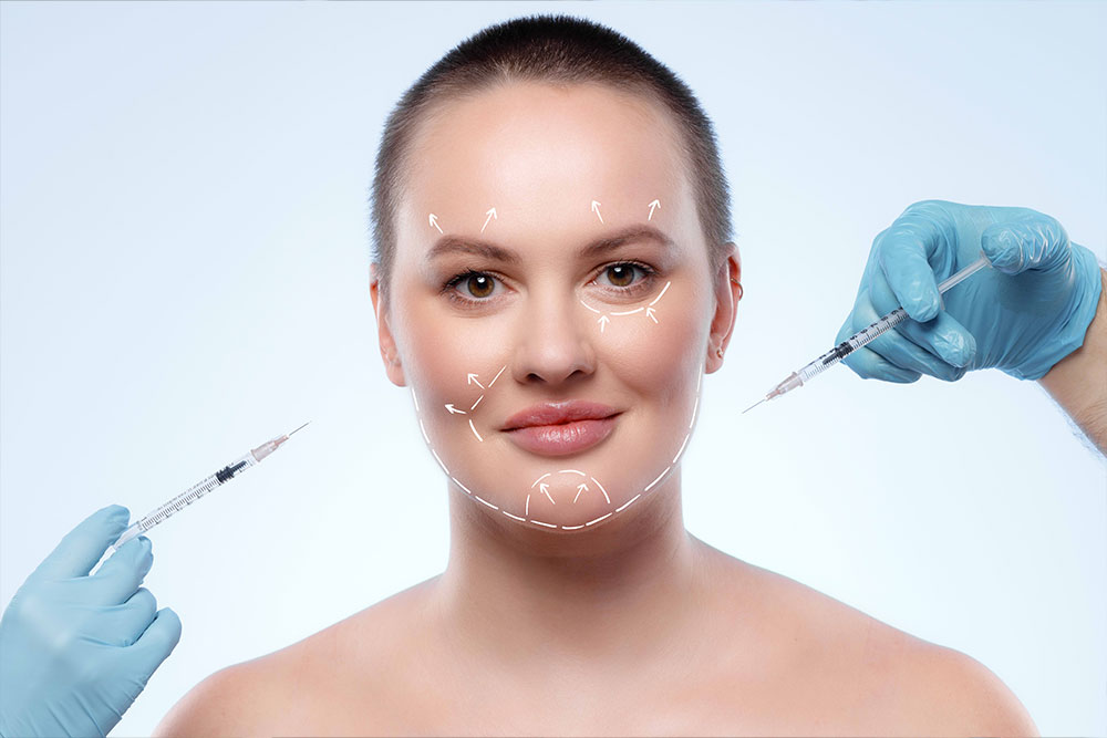 Sculptra Face Injections